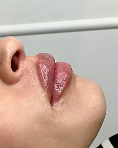 مرکز پوست و زیبایی هلن