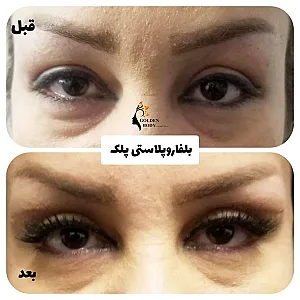 کلینیک پوست مو زیبایی و لیرزگلدن بادی