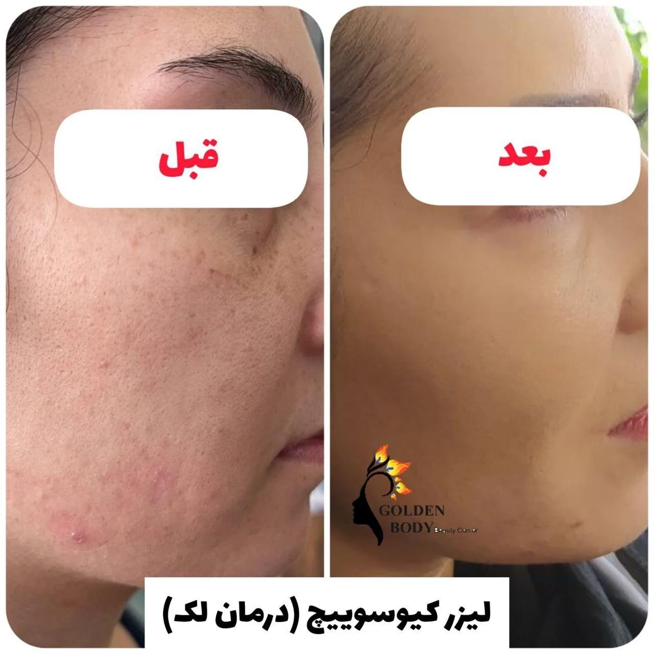 کلینیک پوست مو زیبایی و لیرزگلدن بادی - تصویر 2