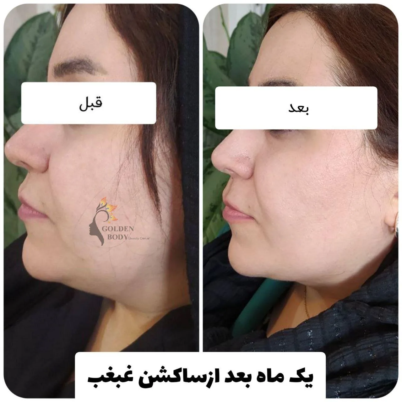 کلینیک پوست مو زیبایی و لیرزگلدن بادی - تصویر 3