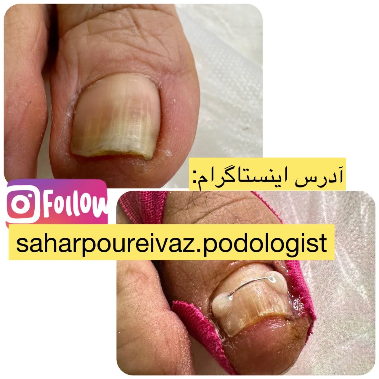 لیزر،پوست،زیبایی سحر پورایواز - تصویر 2