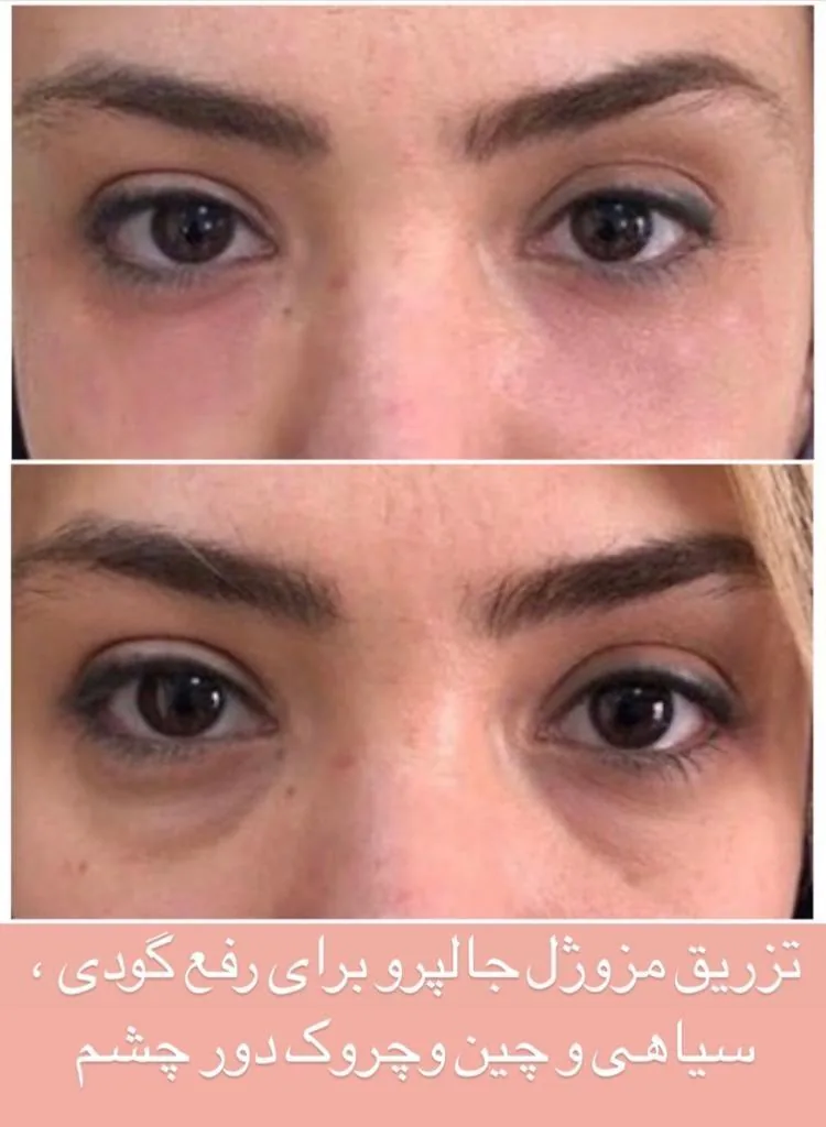 لمیس لانژ - تصویر 4
