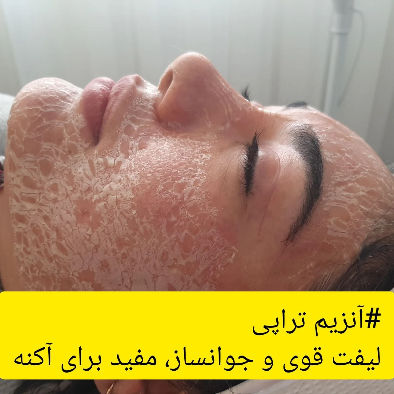 فیشال و مراقبتهای تخصصی پوست - تصویر 3