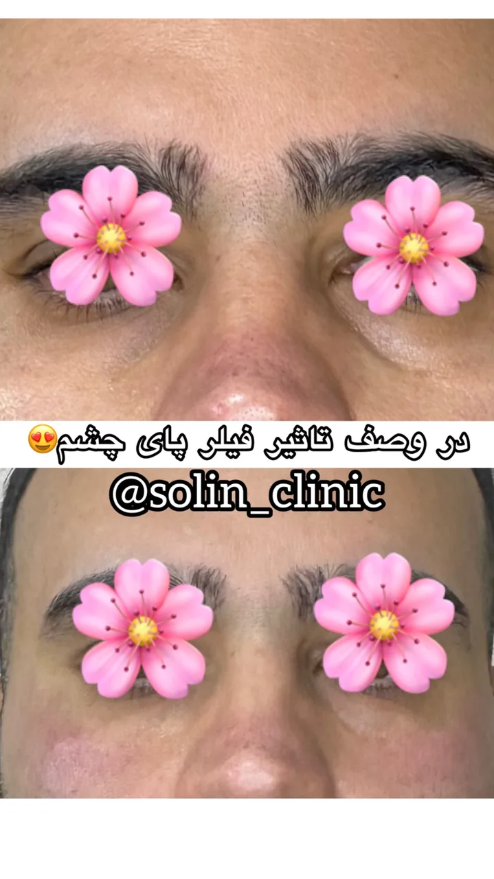 کلینیک زیبایی و لیزر سولین - تصویر 3