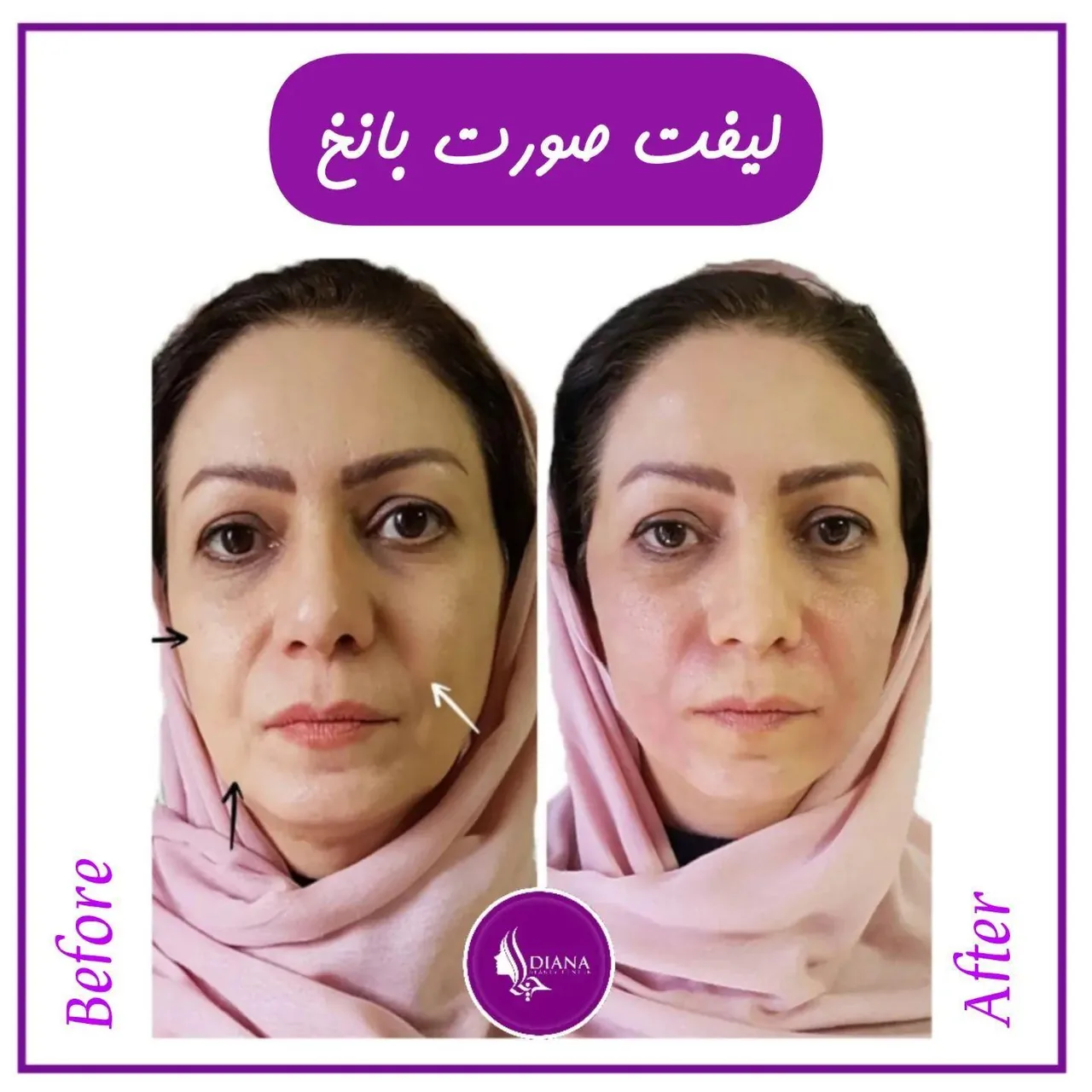 کلینیک زیبایی دیانا - تصویر 4