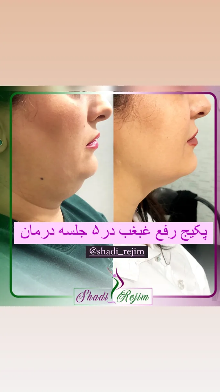 کلینیک لاغری و تناسب اندام شادی ابراهیمی - تصویر 3