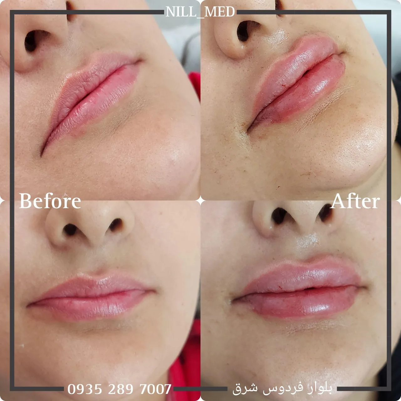 کلینیک پوست مو زیبایی و لیزر نیل - تصویر 2