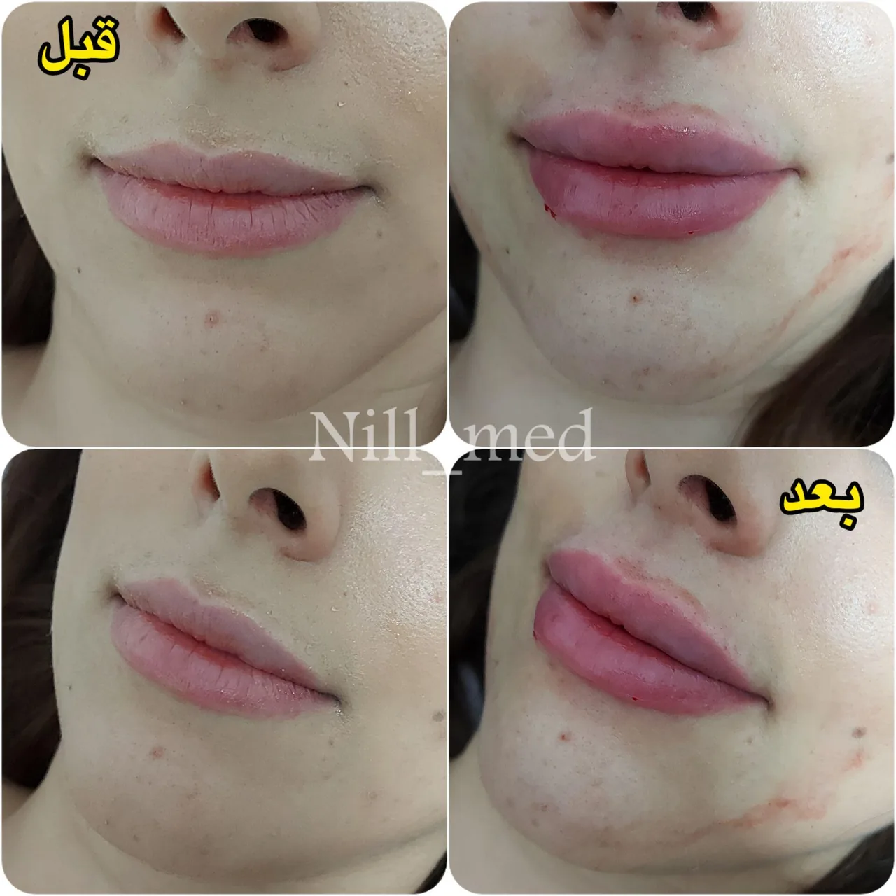کلینیک پوست مو زیبایی و لیزر نیل - تصویر 3