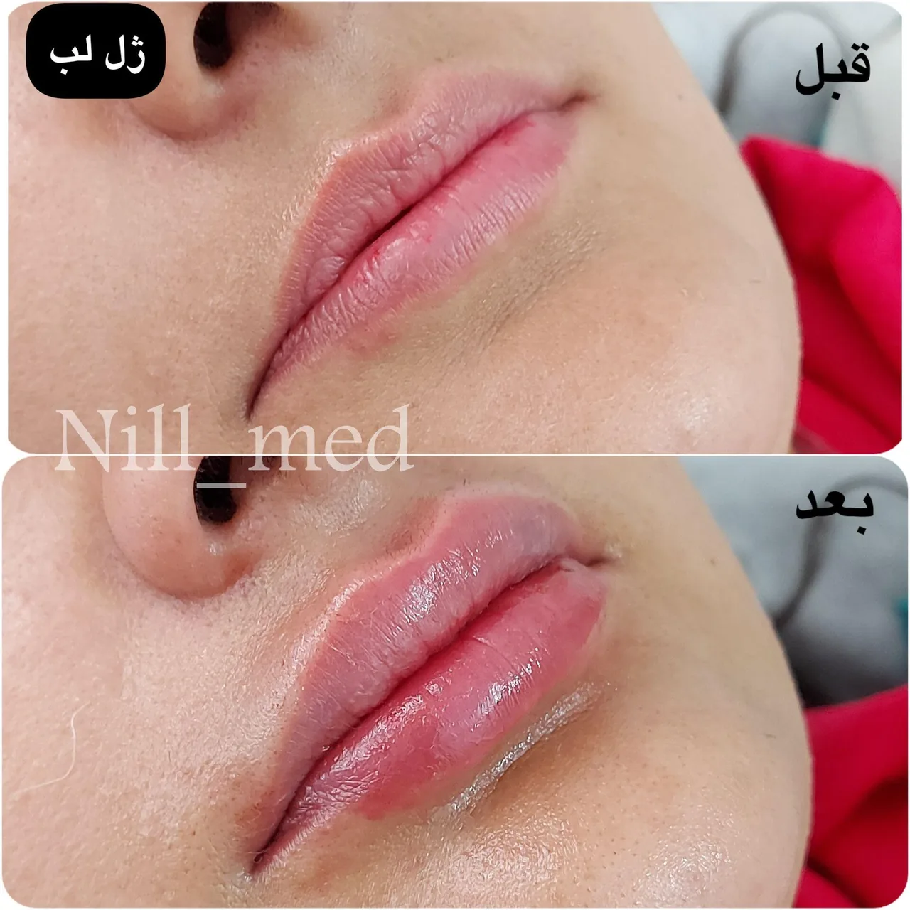 کلینیک پوست مو زیبایی و لیزر نیل - تصویر 4