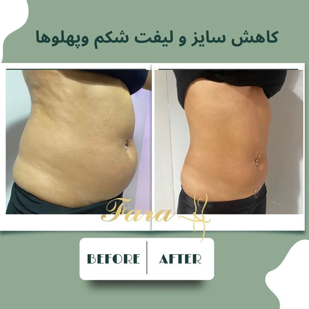 کلینیک پوست مو زیبایی و لاغری فارا - تصویر 2