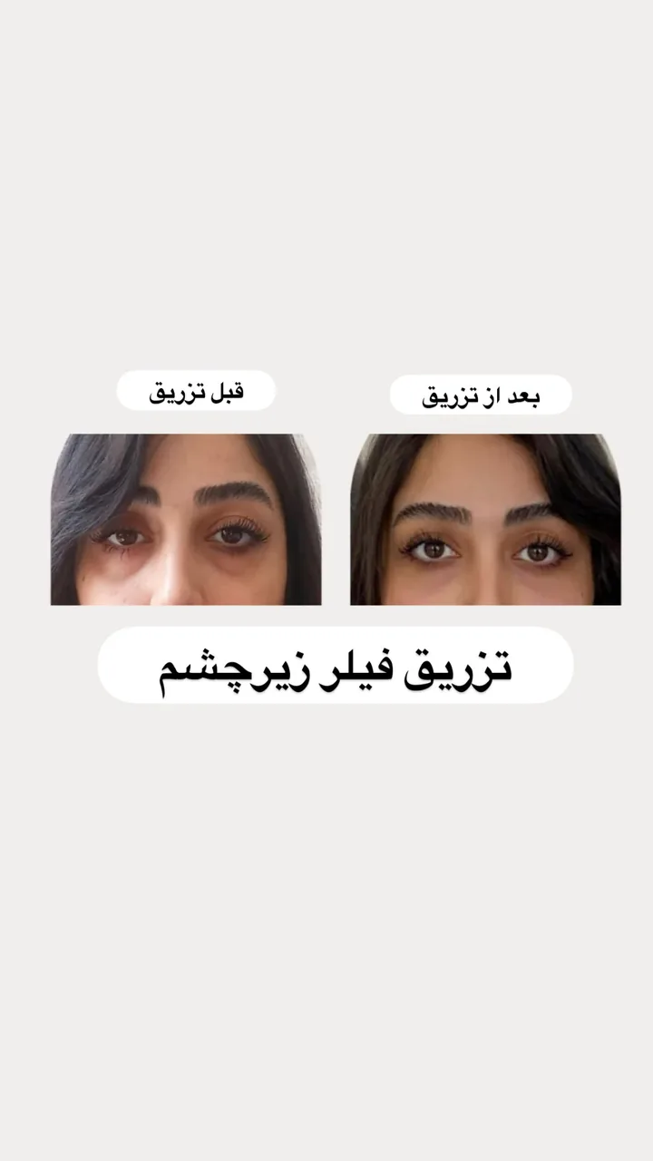 مجموعه  پوست و مو و  لیزرو زیبایی دنیز - تصویر 4