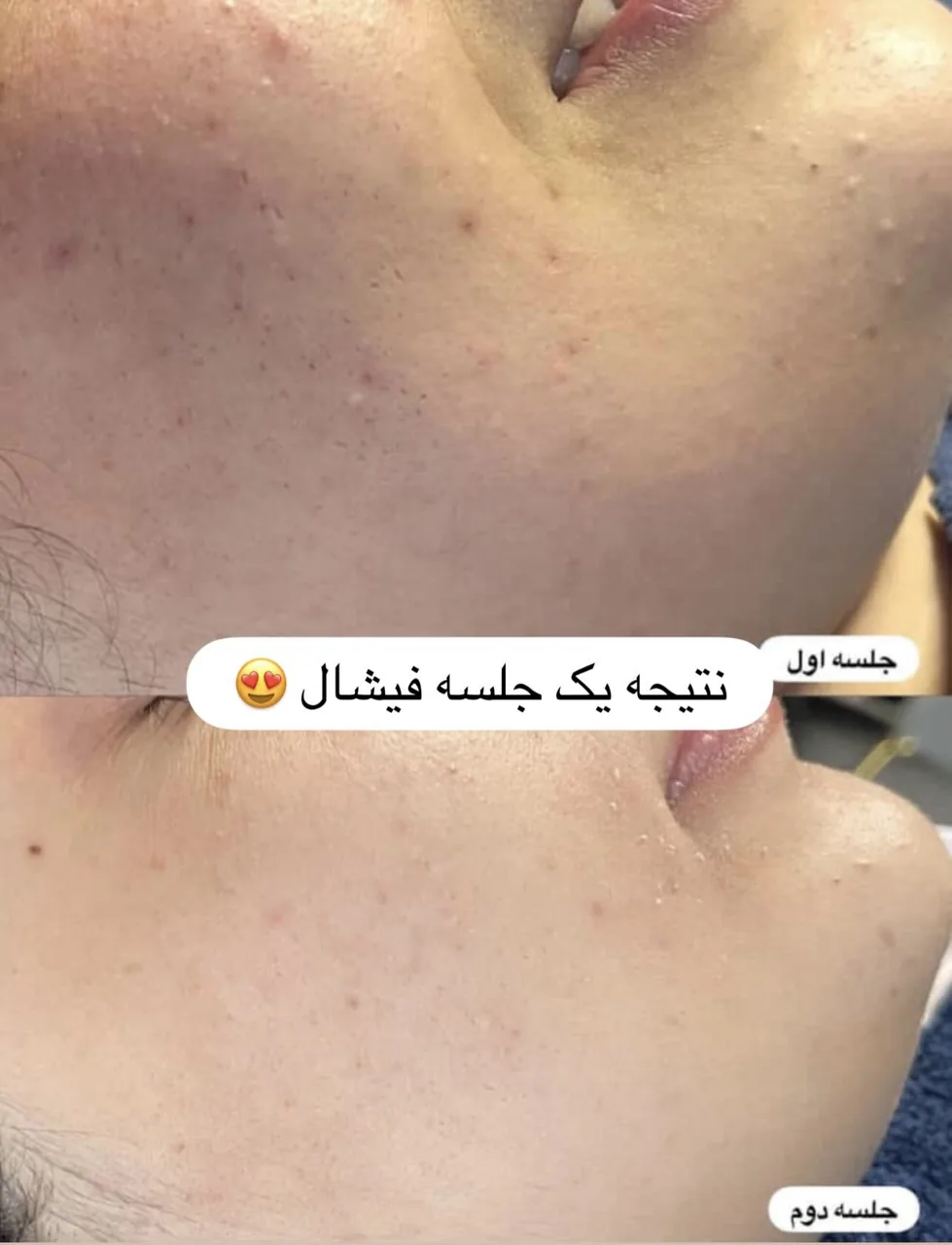 مرکز لیزر ،پوست و زیبایی کندی بیوتی - تصویر 4