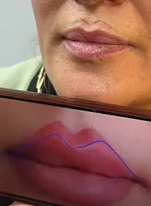 مرکز لیزر و زیبایی پوست و مو لیلیوم