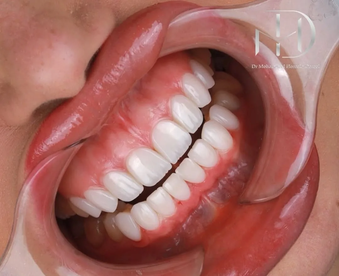 مرکز دندانپزشکی و ایمپلنت با بیمه تکمیلی - تصویر 3