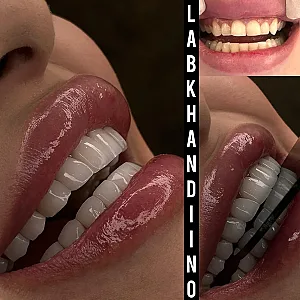 دندانپزشکی لبخندینو