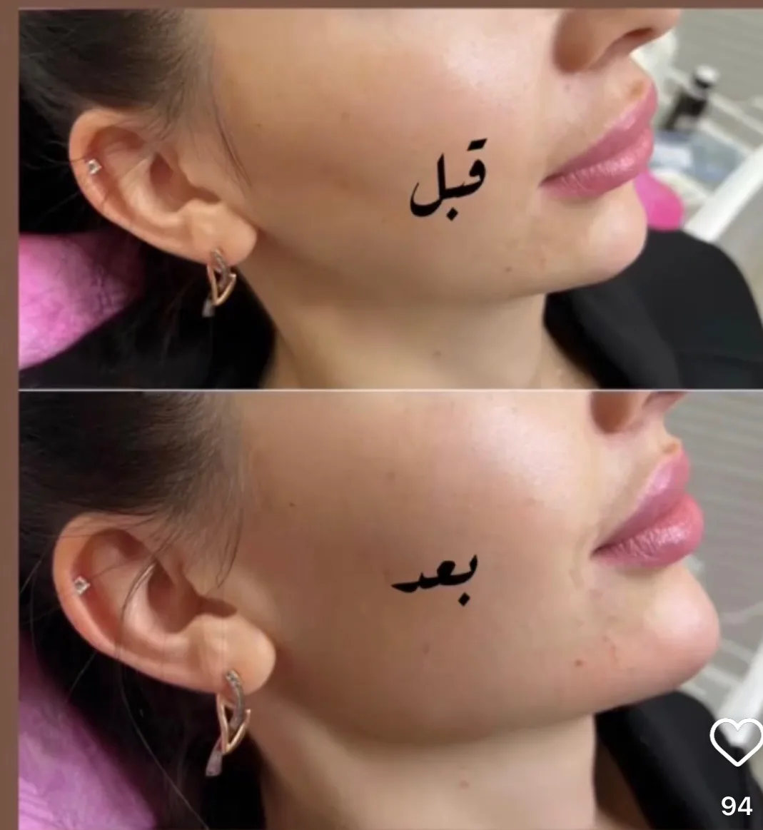 کلینیک زیبایی لیلیان - تصویر 2