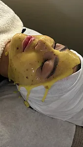 کلینیک پاکسازی و فیشیال پوست سالاری