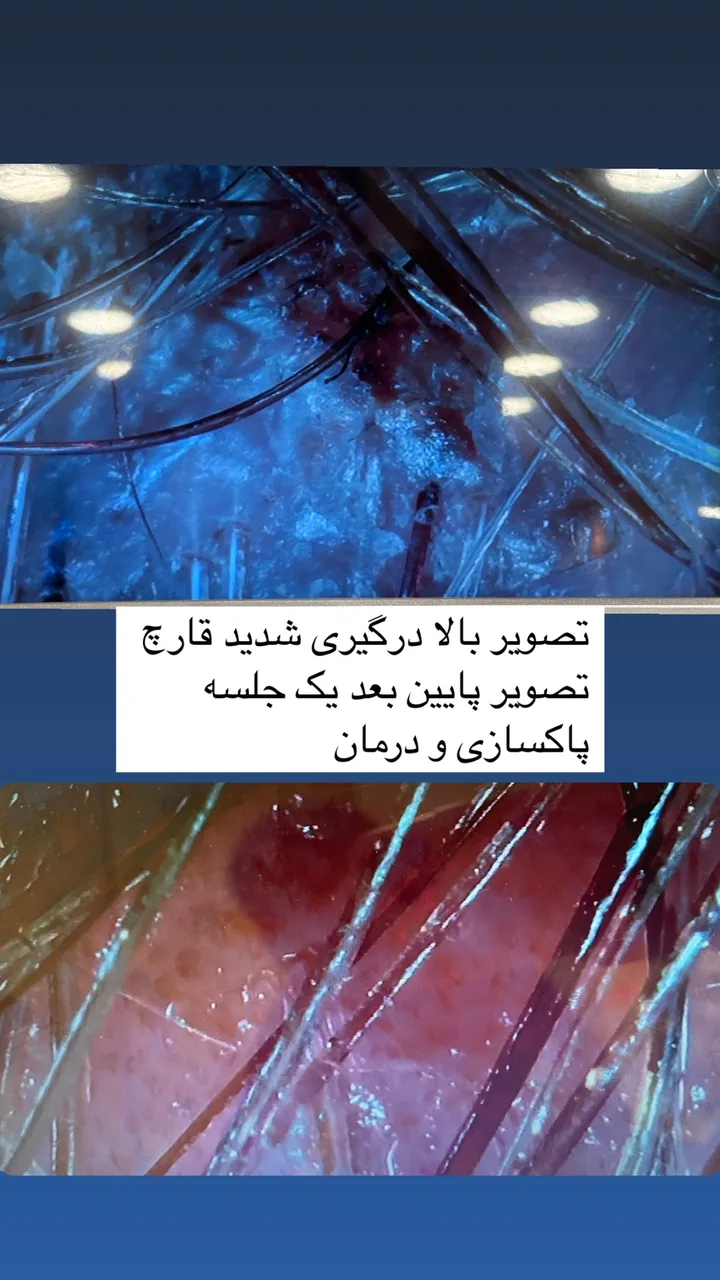 کلینیک پاکسازی و فیشیال پوست سالاری - تصویر 2