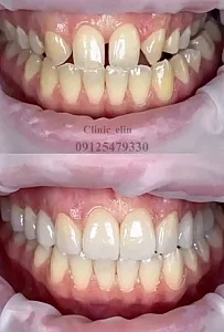 کلینیک تخصصی دندانپزشکی و ایمپلنت الین