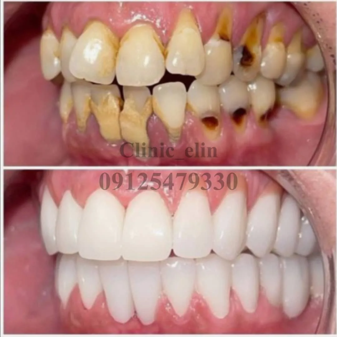 کلینیک تخصصی دندانپزشکی و ایمپلنت الین - تصویر 2