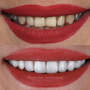 مطب دندانپزشکی دکتر مسعود شاه حسینی