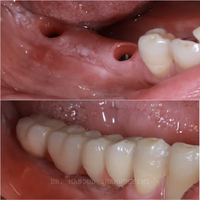 مطب دندانپزشکی دکتر مسعود شاه حسینی - تصویر 3