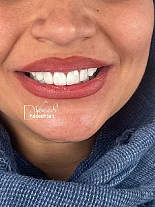 دکتر فرشته احمدی دندانپزشک(بیمه نداریم)