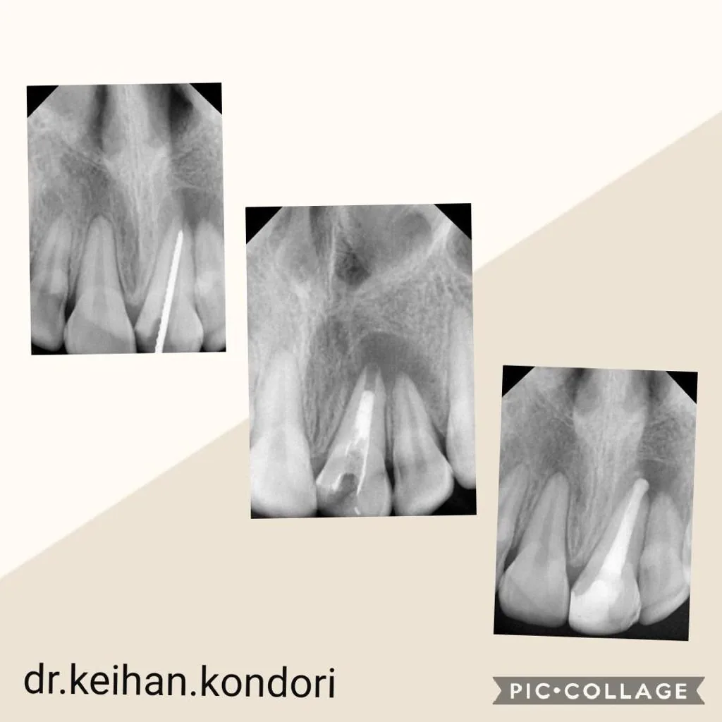 دندانپزشکی دکتر کیهان کندری - تصویر 4
