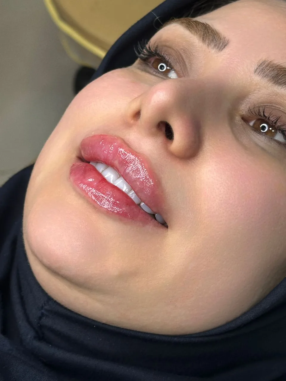مرکز لیزر کلینیک پوست و مو فریسا - تصویر 4