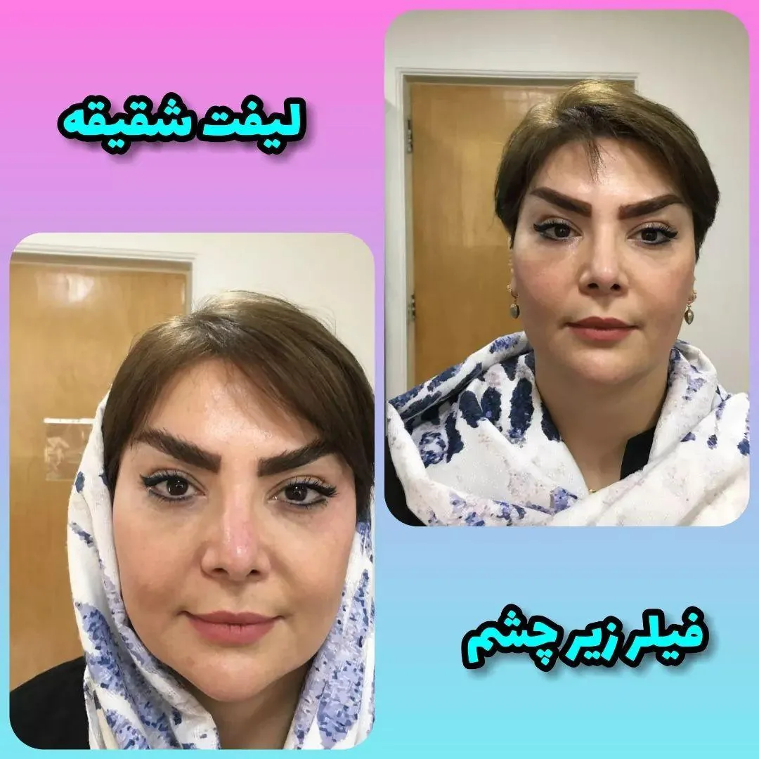 مزکز زیبایی لیا - تصویر 2
