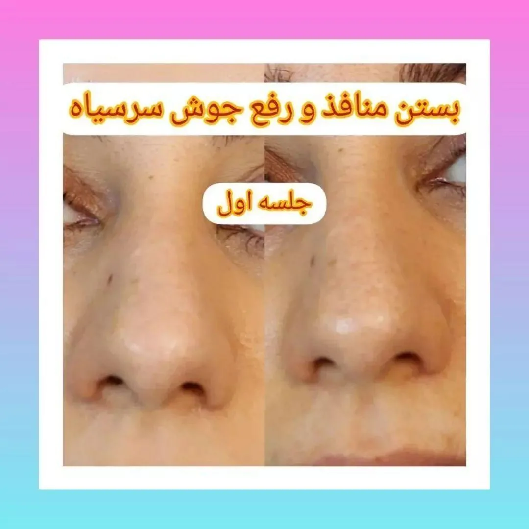 مزکز زیبایی لیا - تصویر 4