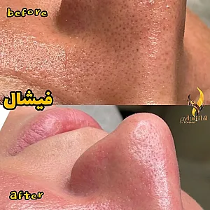 کلینیک هانیسا