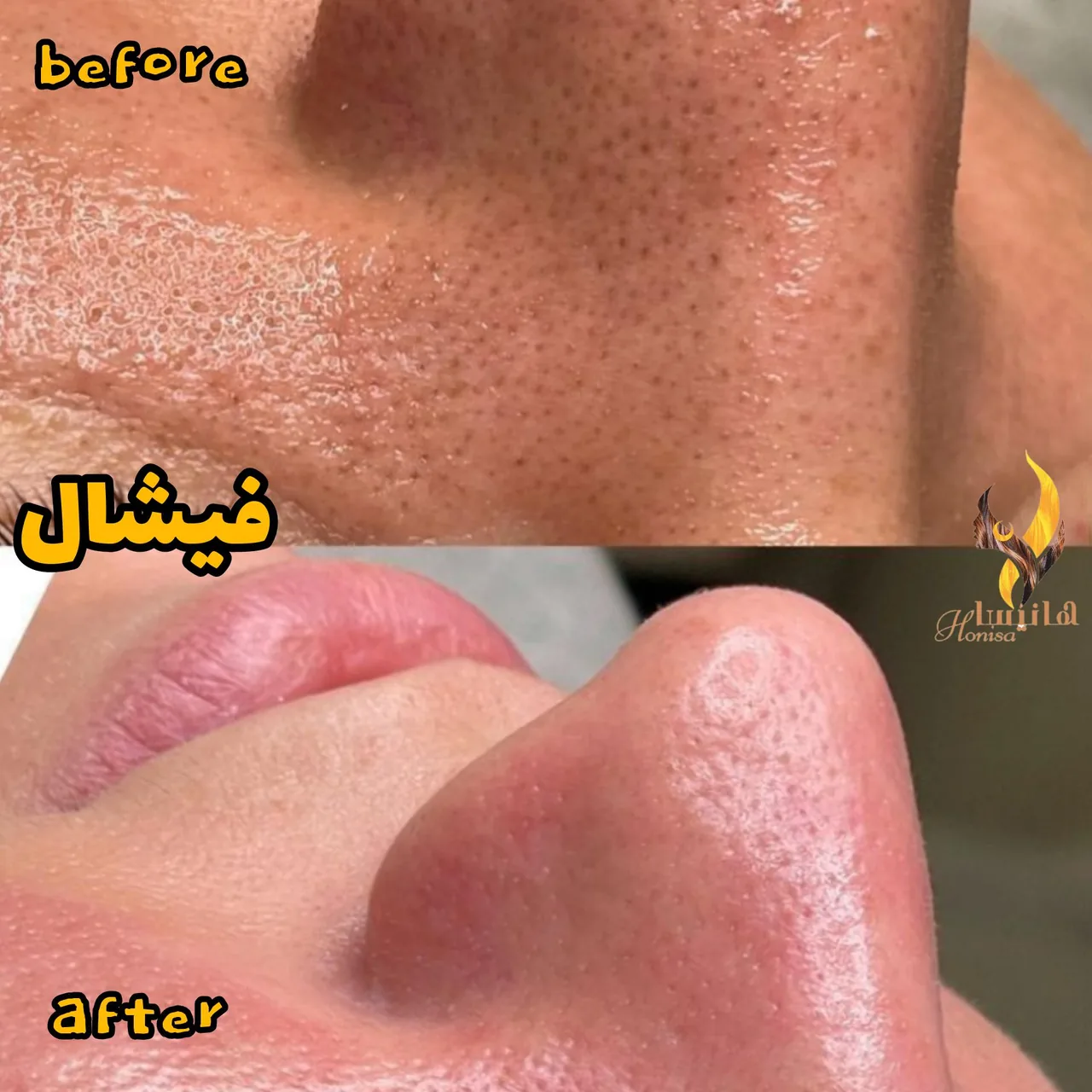 کلینیک هانیسا