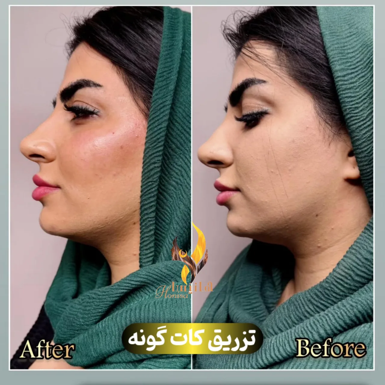 کلینیک هانیسا - تصویر 2