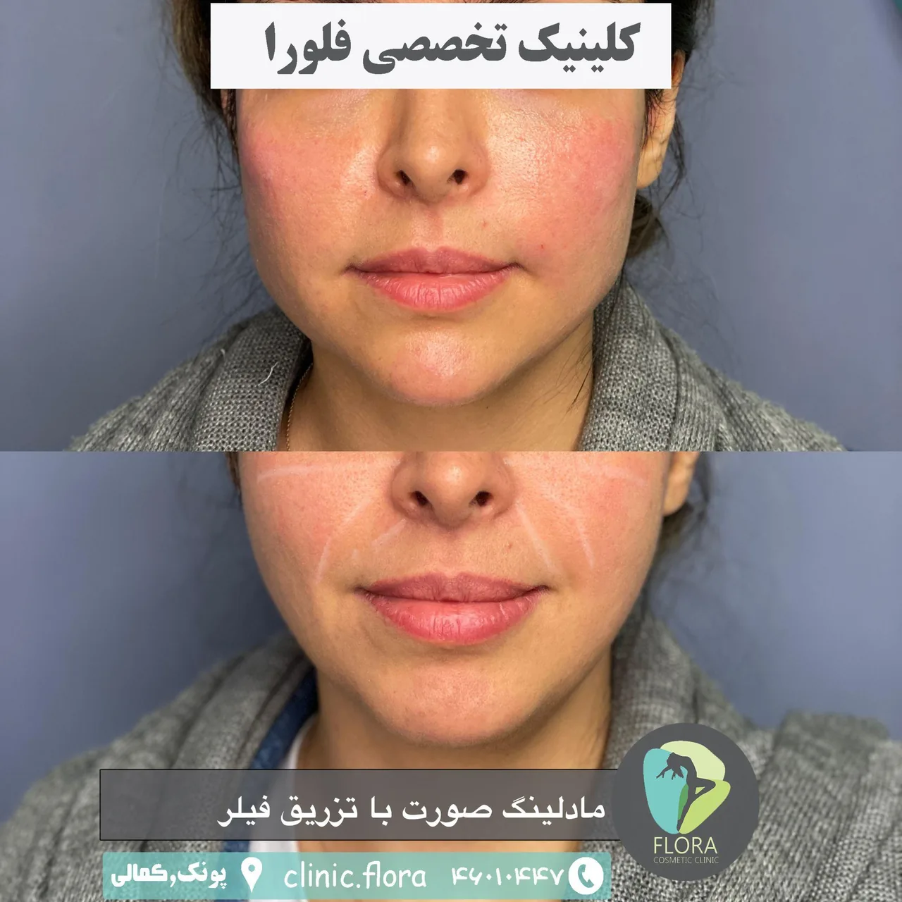کیلینیک زیبایی فلورا - تصویر 3