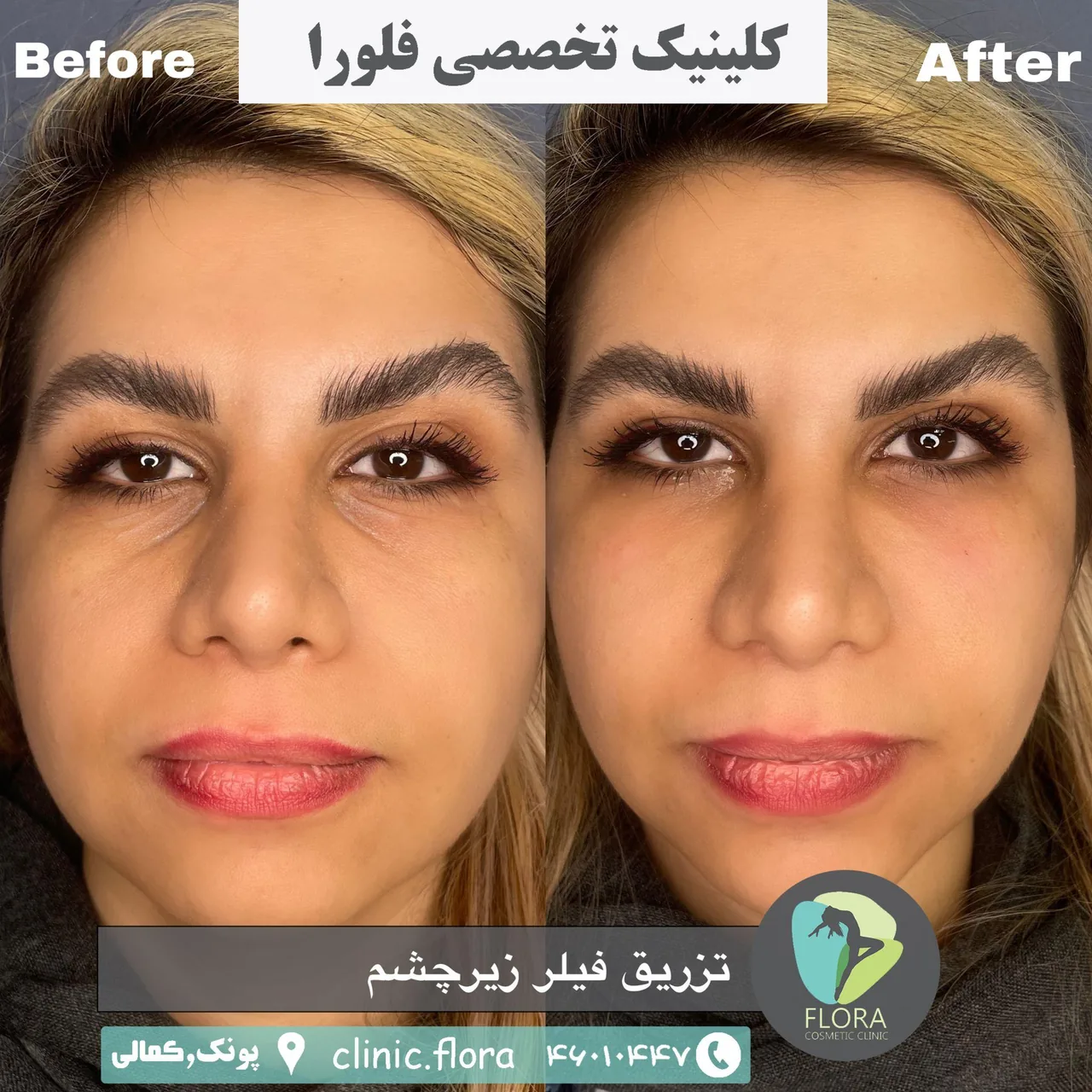 کیلینیک زیبایی فلورا - تصویر 4