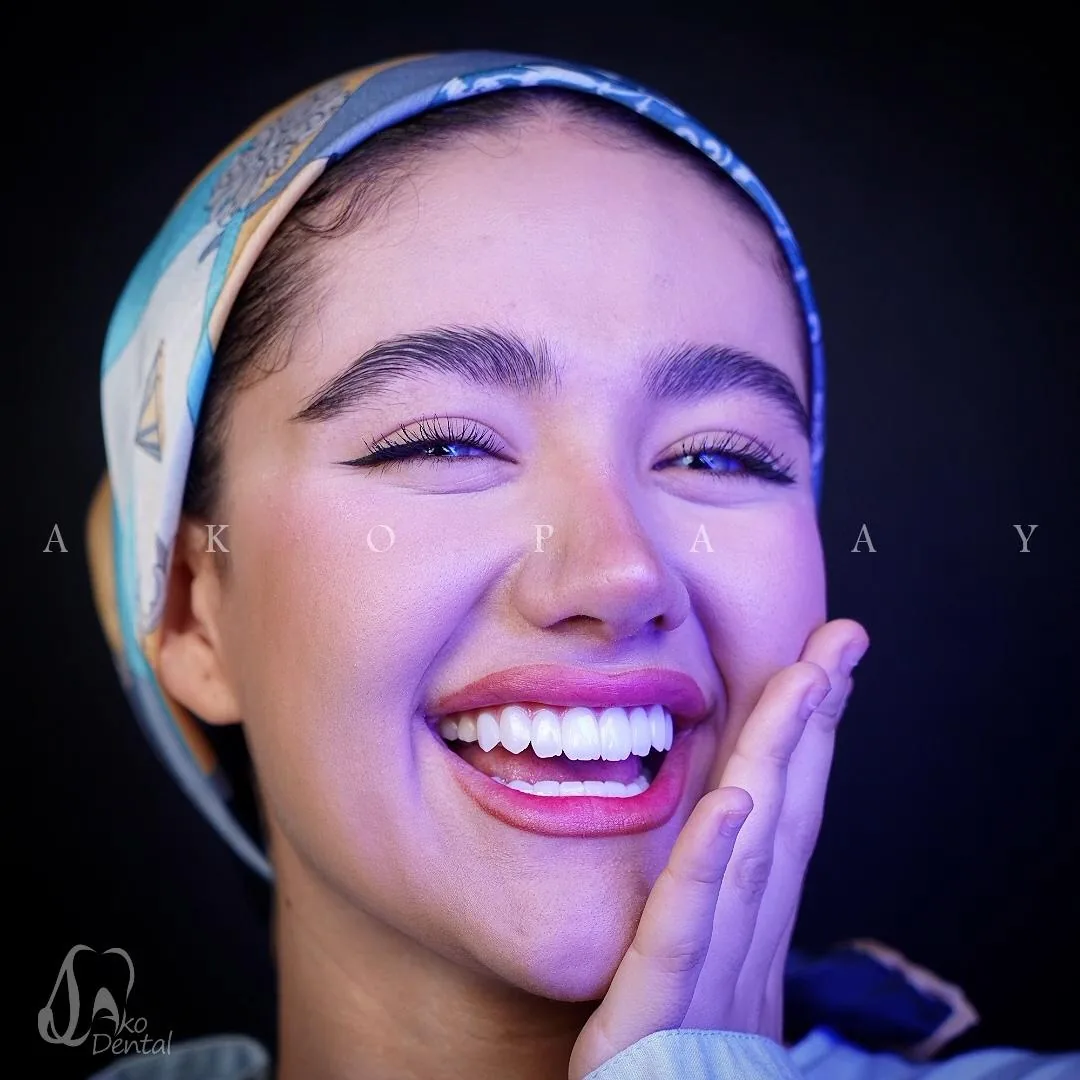 دندانپزشکی آکوپی - تصویر 3