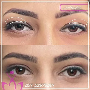 کلینیک لاغری و زیبایی نرگسان بیوتی