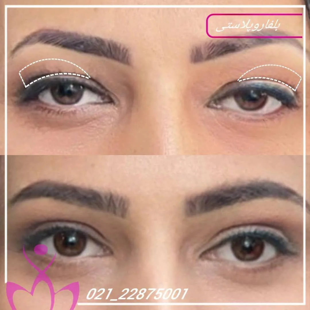 کلینیک لاغری و زیبایی نرگسان بیوتی