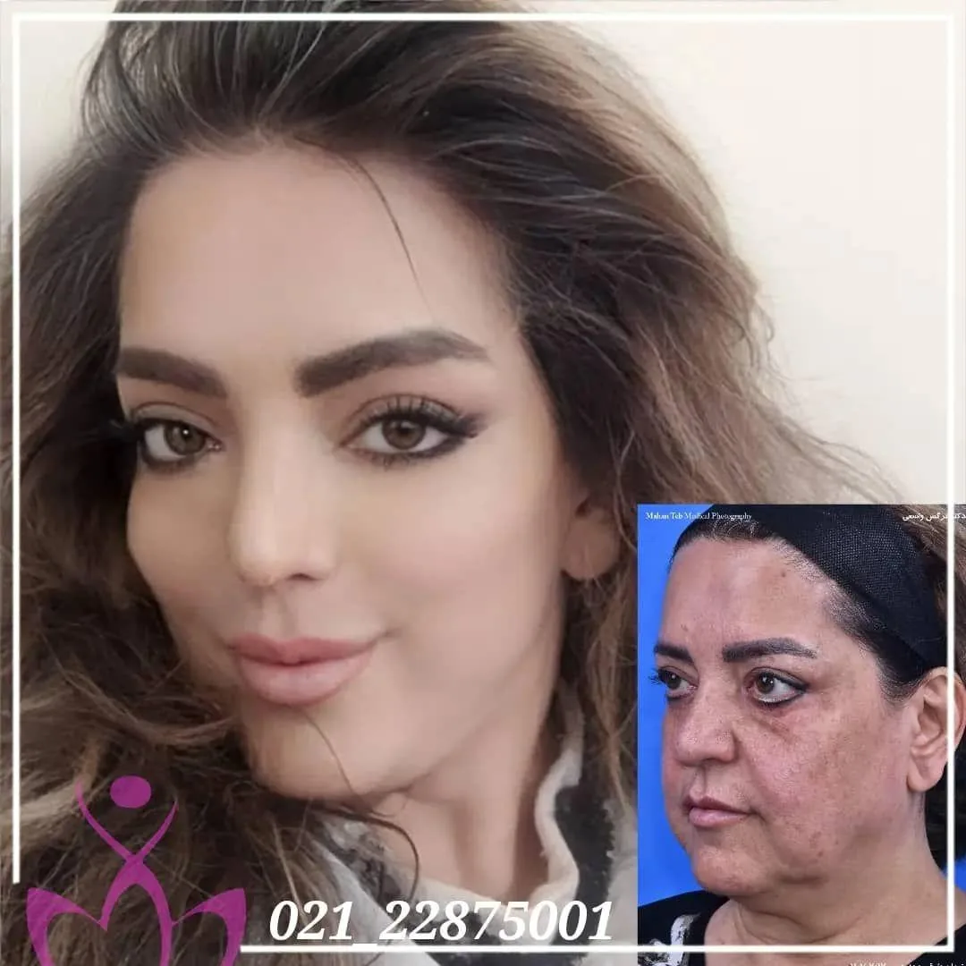 کلینیک لاغری و زیبایی نرگسان بیوتی - تصویر 2