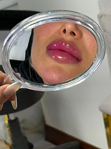 کلینیک زیبایی بنیتا