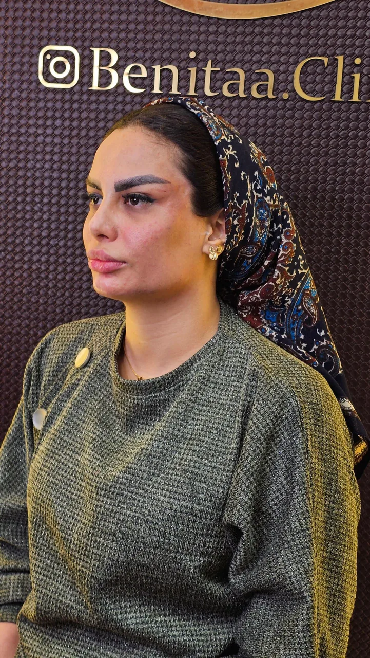 کلینیک زیبایی بنیتا - تصویر 3