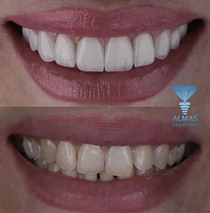 کلینیک دندانپزشکی الماس
