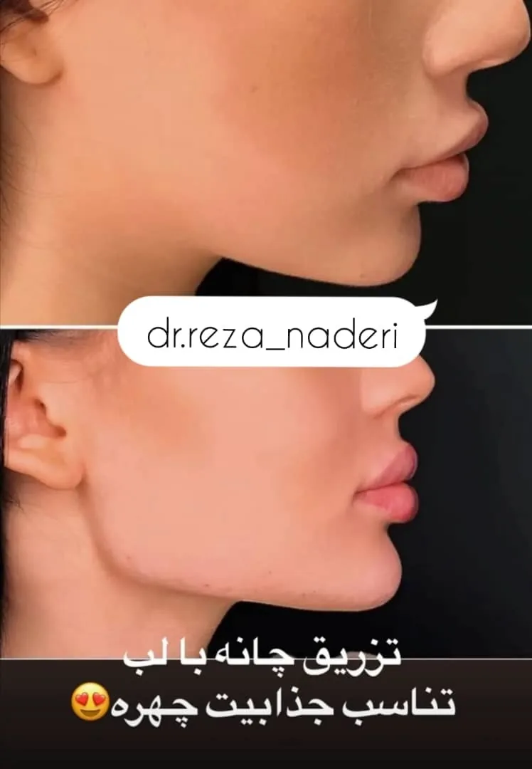 مرکز زیبایی و لیزر دکتر رضا نادری - تصویر 2