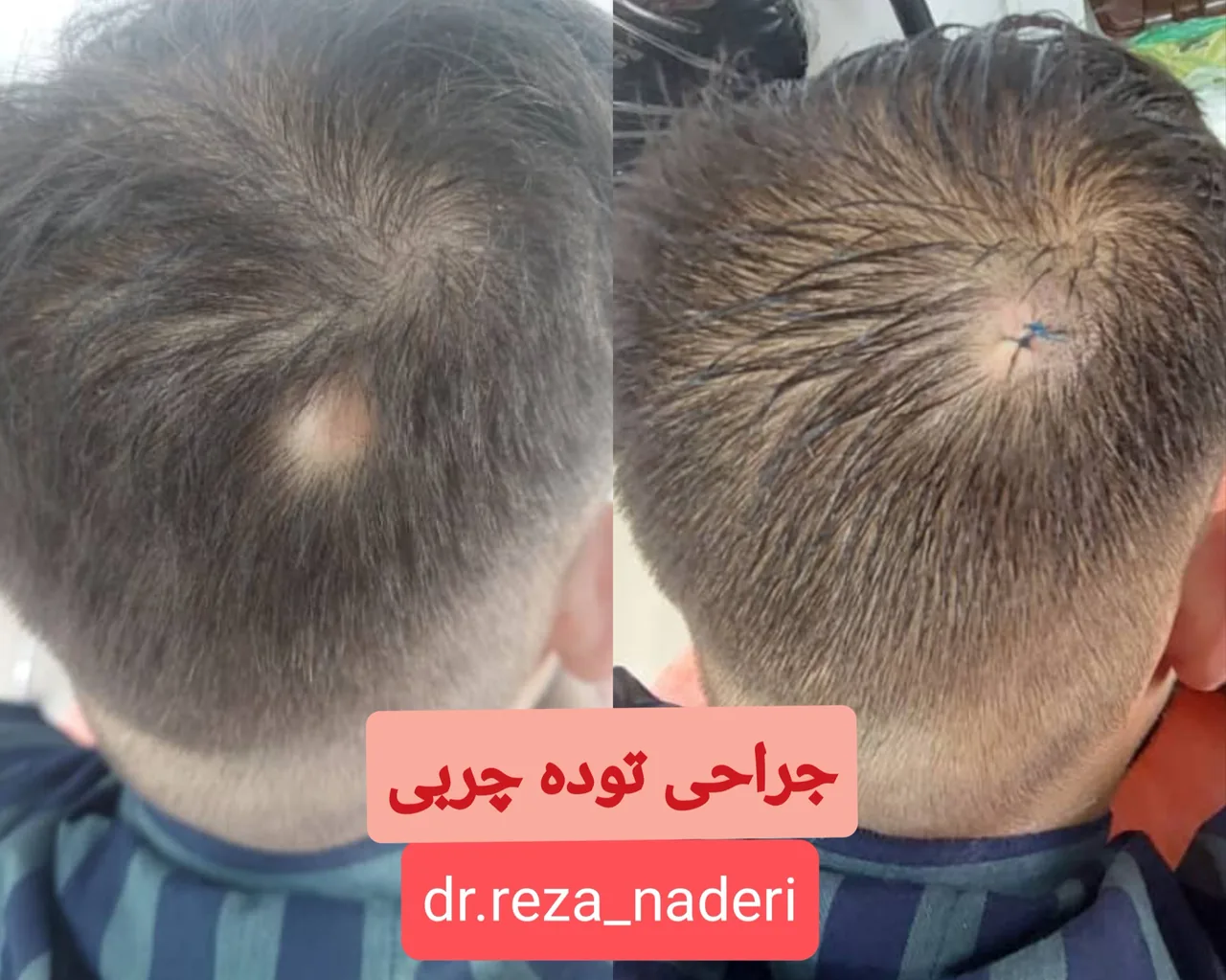 مرکز زیبایی و لیزر دکتر رضا نادری - تصویر 3