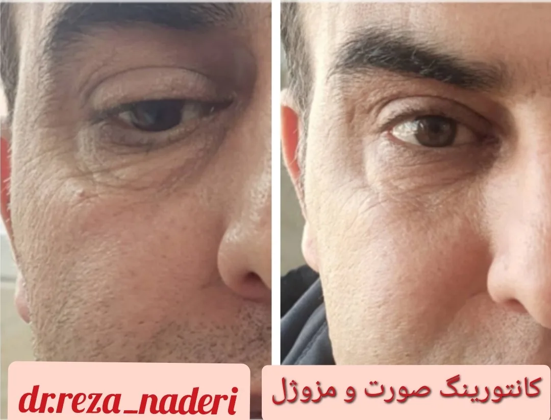 مرکز زیبایی و لیزر دکتر رضا نادری - تصویر 4