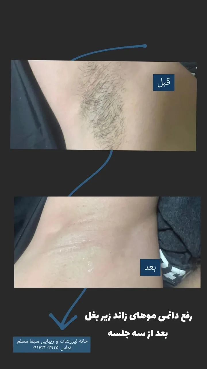 کلینیک لیزر و زیبایی سیما مسلم