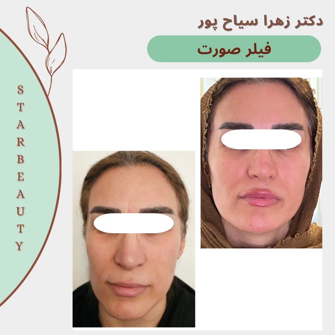 مرکز لیزر مرکز زیبایی دکتر زهرا سیاح پور - تصویر 2