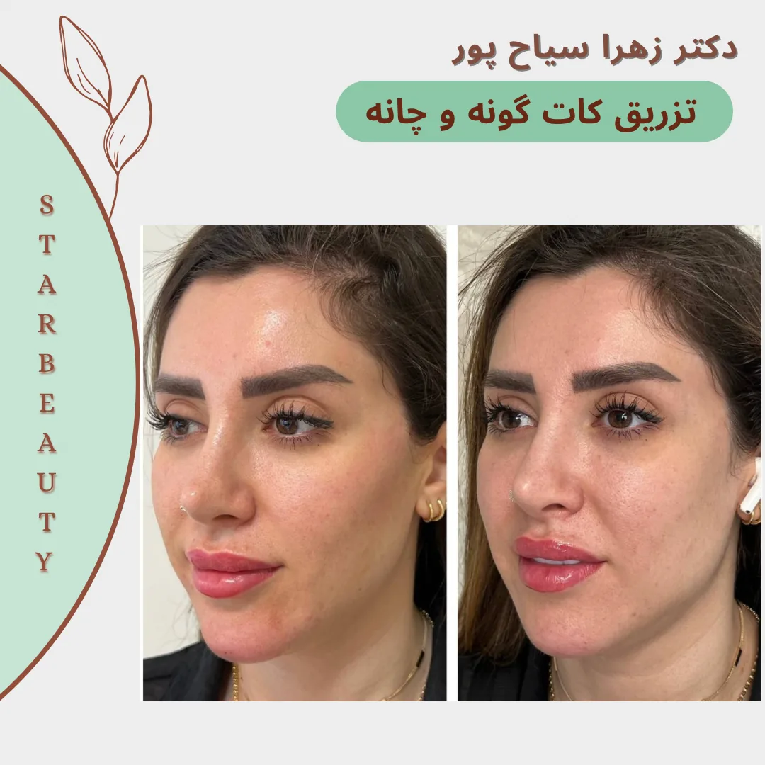 مرکز لیزر مرکز زیبایی دکتر زهرا سیاح پور - تصویر 3