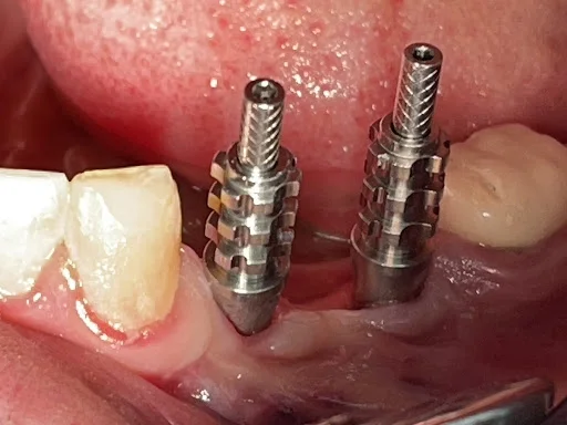 دندانپزشکی دکتر فتح اله عباسپور